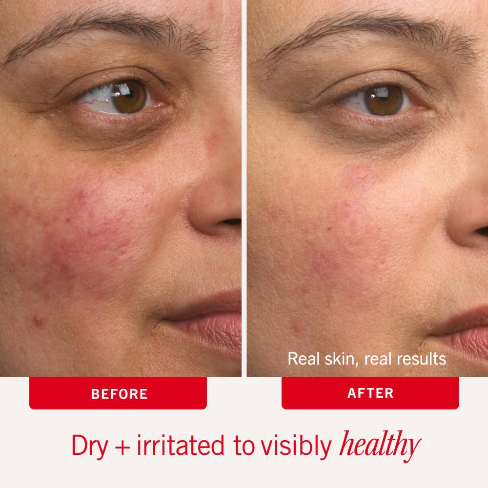 First Aid Beauty Ultra Repair Cream 56.7g - Image 6