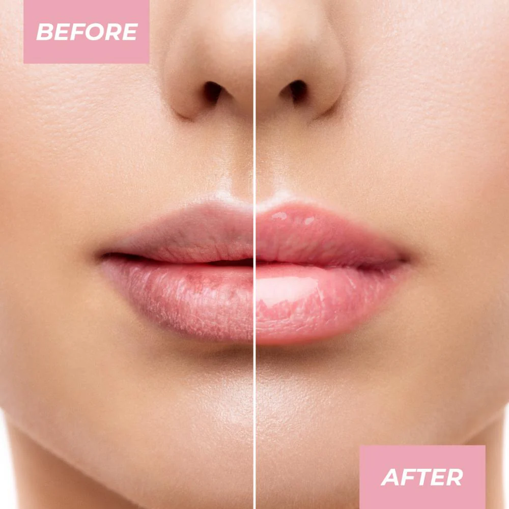 MCoBeauty Overnight Lip Mask Deluxe Trio 3g 3pk - Image 5