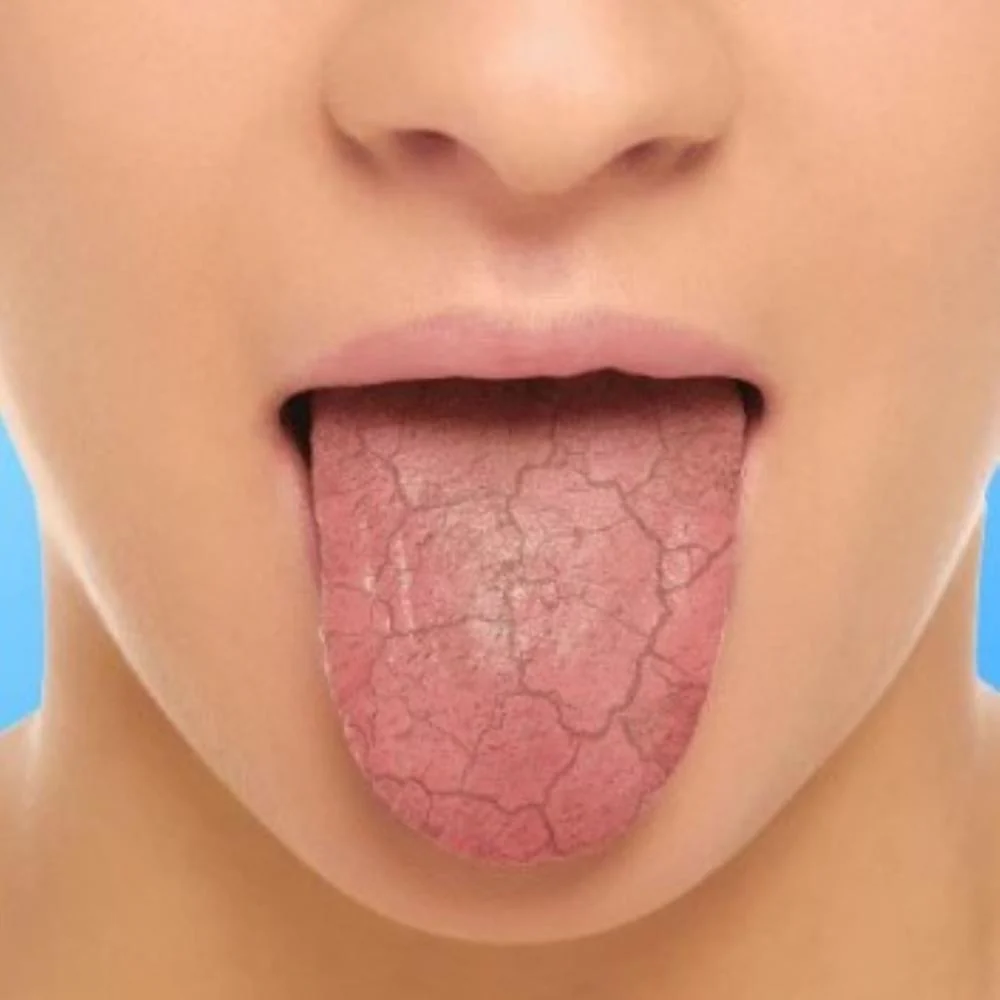Xerostom Pastilles 30pk - Image 3
